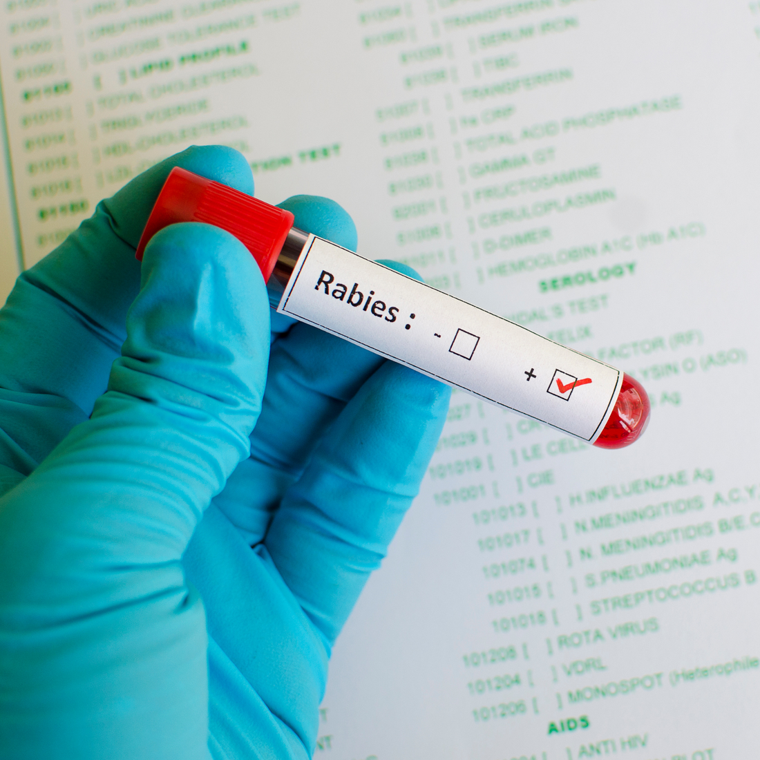 What You Need To Know About Rabies